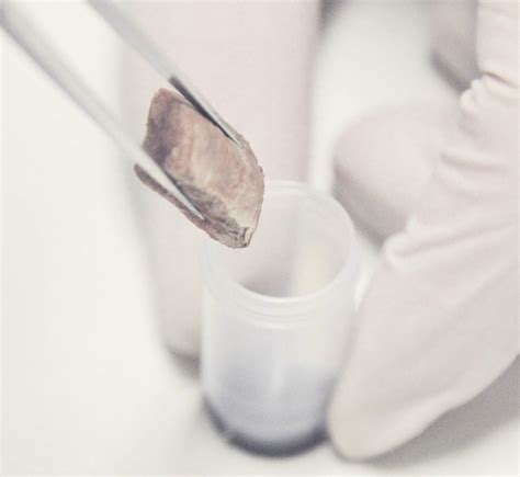 Image result for Caustic Tissue Sample