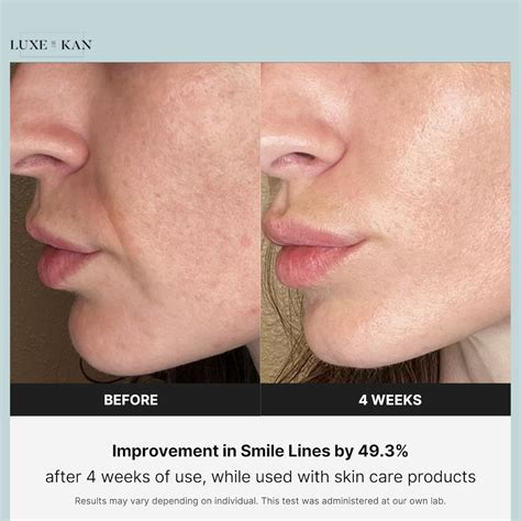 Medicube Age-R Derma EMS Shot - Facial Contouring – Luxe by Kan