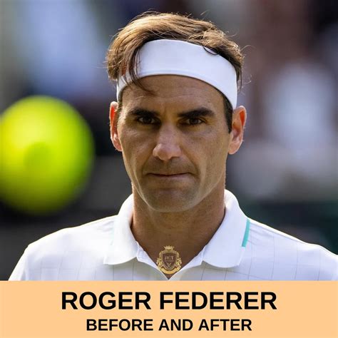 Roger Federer Hair Transplant - Hair Center of Turkey