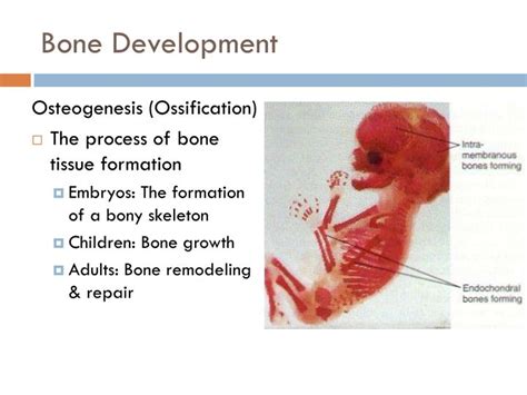 Bone Development Algorithm 的图像结果