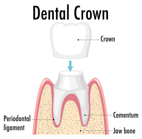 Dental crown Images - Free Download on Freepik