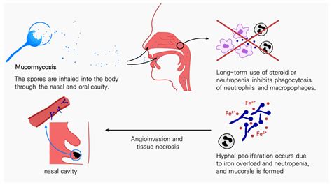 COVID-19 and Fungal Diseases