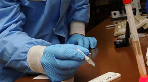 Monospot Test : मोनोस्पॉट टेस्ट क्या है? जानें प्रक्रिया व परिणाम ...