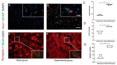 Image result for Contralateral Brain Injury