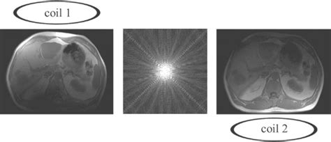 Image result for Parallel Imaging Applications