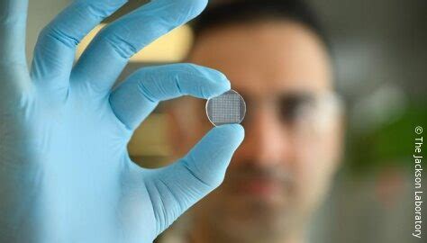 Microneedle skin patch enables immune monitoring