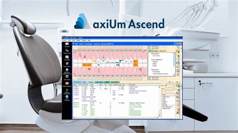 Image result for SoftDent Tutorial