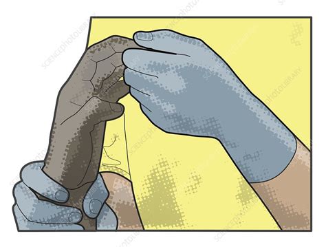 Image result for Blood Circulation Testing