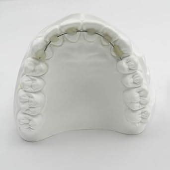 Dentosmile Dental/Orthodontic Dead-Soft Lingual Retainer Wire | 20 Ft ...