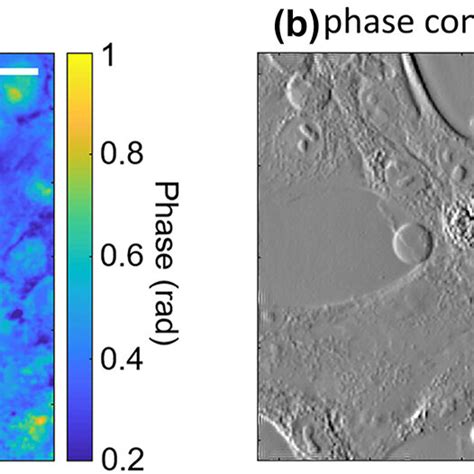 Image result for Phase Contrast Diffraction