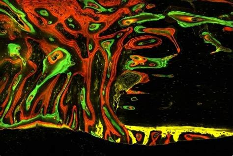 Image result for Bone Tissue Formation