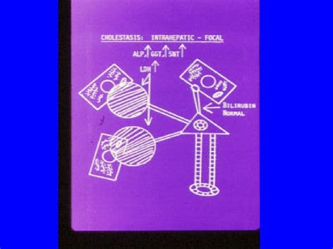 Image result for Hepatic Function