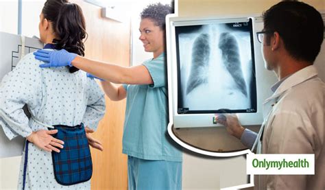 Know The Process Of Chest X Ray Test And When Is It Needed In Hindi ...