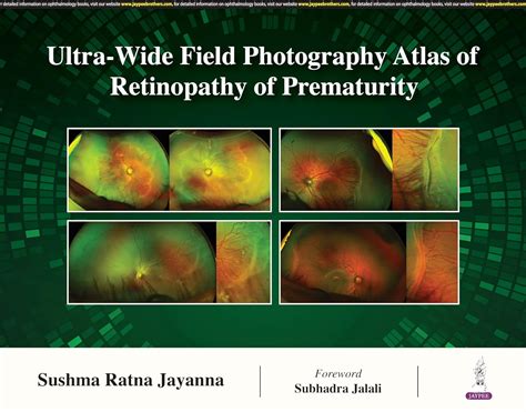 Buy ULTRA- WIDE FIELD PHOTOGRAPHY ATLAS OF RETINOPATHY OF PREMATURITY ...