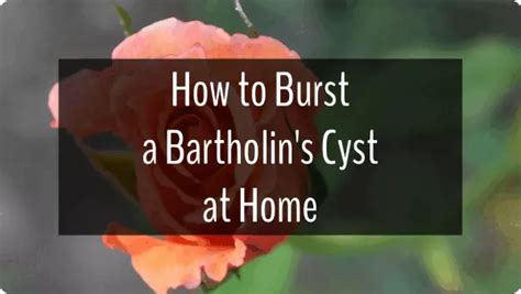 Cyst at Home Burst 的图像结果