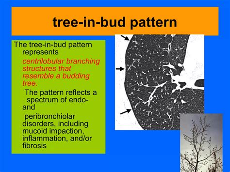 Thoracic imaging terminology | PPT