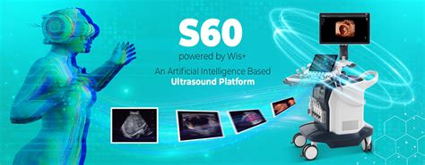 Best Medical Equipment Companies In India | Sonoscape India