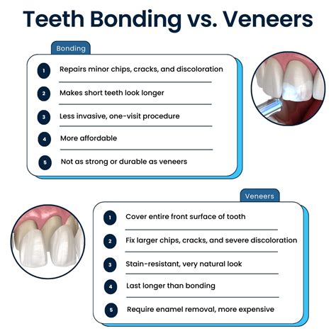 Teeth Bonding vs. Veneers: What You Didn’t Know | Broadway Family Dental