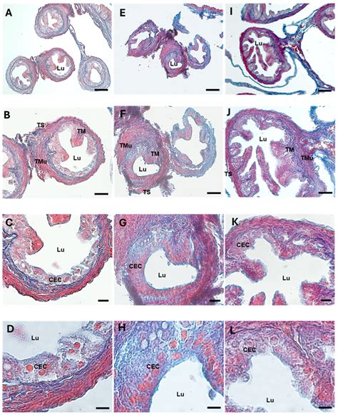 Morphological and Redox/Glycative Alterations in the PCOS Oviducts ...