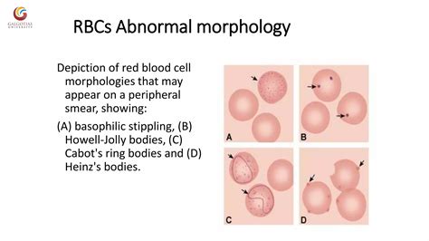 Abnormal morphology of rbc notes | PDF