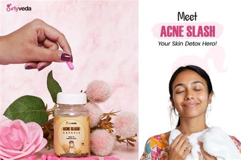 Acne Slash Capsules: Best Ayurvedic Medicine for Pimples on Face ...