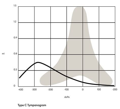 Hearing Loss in Adults