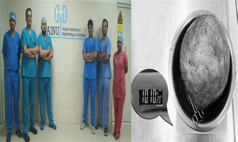 10 కిలోల ఫుట్‌బాల్ పరిమాణంలో ఉన్న పొత్తికడుపు కణితి తొల‌గింపు | 10 Kg ...