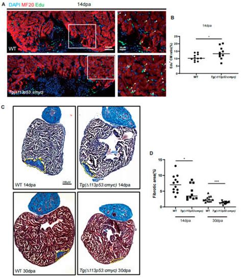 Tg(Δ113p53:cmyc) Transgene Upregulates glut1 Expression to Promote ...