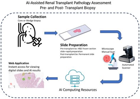 Artificial Intelligence Advances in Transplant Pathology