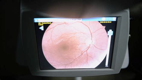 Image result for Computer Eye Exam