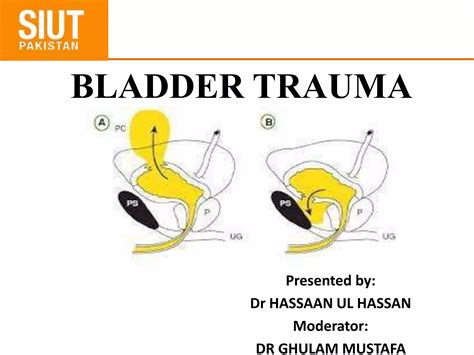 Image result for Bladder Explode