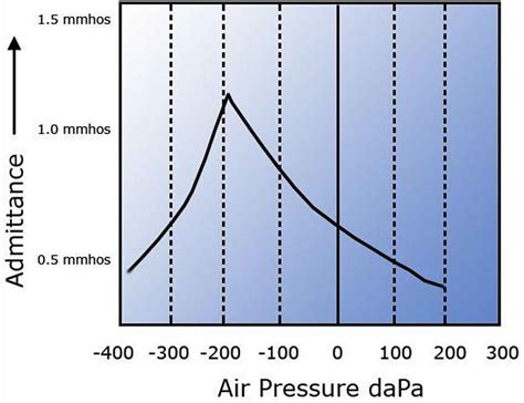 Tympanometry test, tympanometry types & abnormal tympanometry results