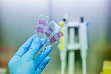 How To Find Cost-Effective Tissue Samples - iProcess