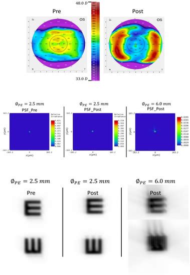 Optics | Special Issue : Advances in Vision Optics, Myopia Control and ...
