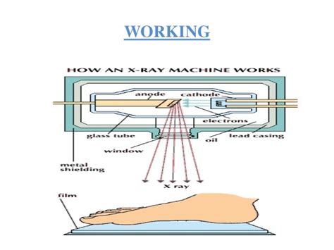 Image result for X-ray Tutorials