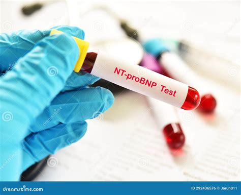 Blood Sample for NT-proBNP Test Stock Photo - Image of chronic, sample: 292436576