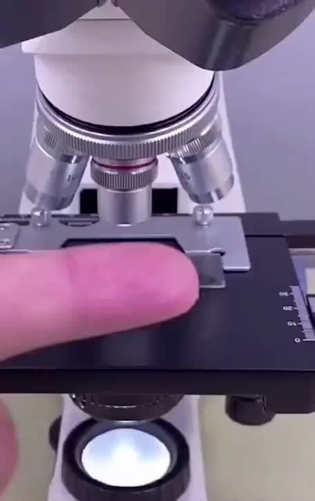 Image result for Finger Under Microscope