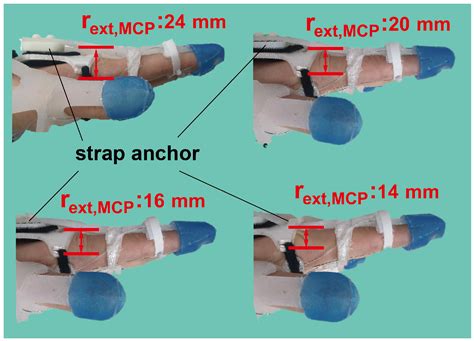 Design Optimization of a Soft Robotic Rehabilitation Glove Based on ...