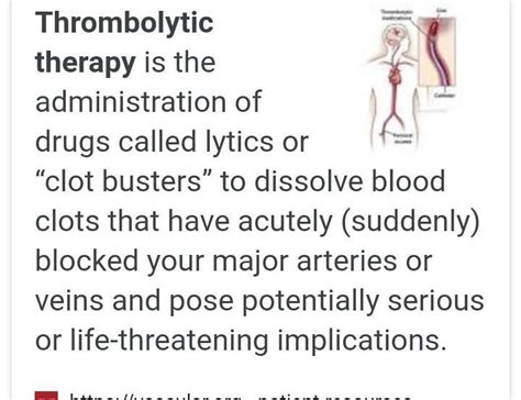 define thrombolytic therapy - Brainly.in