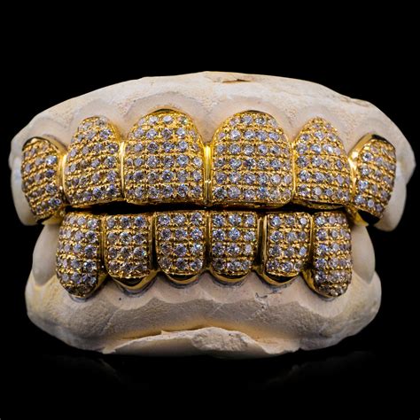 Buy Iced Diamond Grillz for Teeth Online - ON SALE Today! - Custom Gold ...