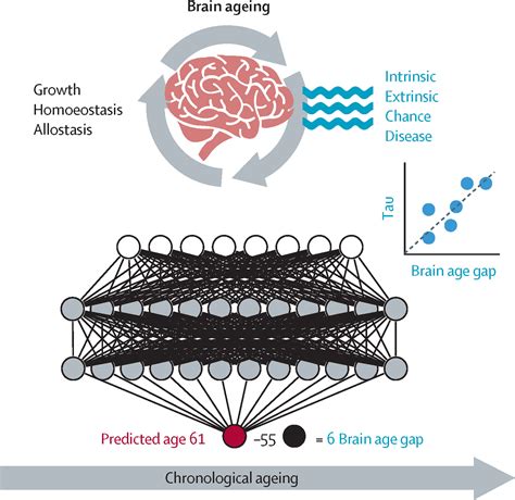 Digitising brain age - The Lancet
