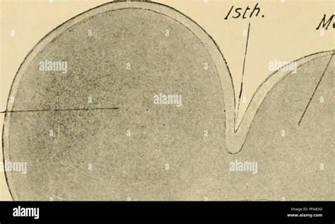 Image result for Lamina Terminalis Embryonic Development