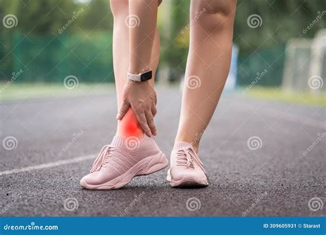 Achilles Tendon Injury, Callus on the Heel while Running, Foot Pain, Woman Suffering from Feet ...