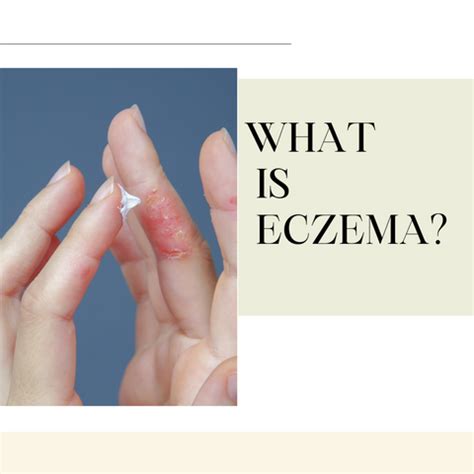 7 Types of Eczema: Symptoms, Causes & Treatment | Clinikally
