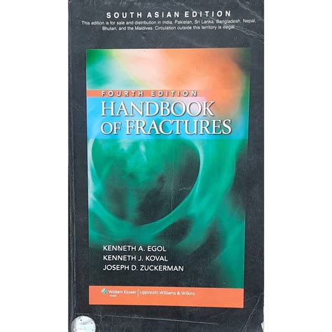 Handbook Of Fractures : South Asia edition by Kenneth A Egol – Inspire ...