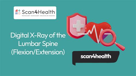 Digital X-Ray of the Lumbar Spine (Flexion/Extension) - Scan4Health ...
