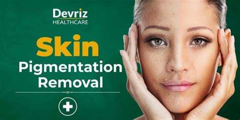 Devriz Healthcare: Best Skincare Solutions for Pigmentation