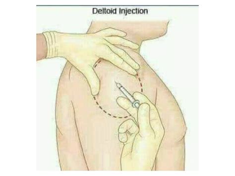 Injection Method Tutorial 的图像结果