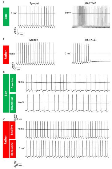 Investigating LMNA-Related Dilated Cardiomyopathy Using Human Induced ...