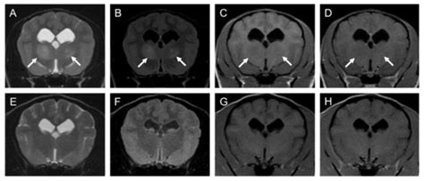 Successful Treatment of Central Nervous System Lymphoma with ...